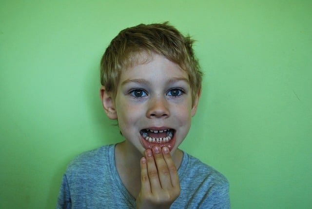 5 דרכים לשמור על השיניים של הילדים שלכם